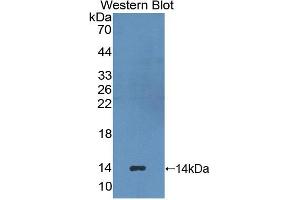 Western blot analysis of the recombinant protein. (HAVCR1 Antikörper  (AA 23-125))