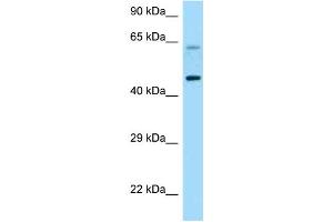 WB Suggested Anti-CRHR1 Antibody Titration: 1. (CRHR1 Antikörper  (C-Term))