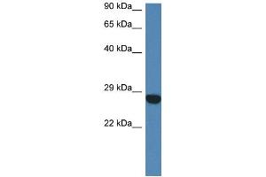 WB Suggested Anti-Ccdc90b Antibody   Titration: 1. (CCDC90B Antikörper  (N-Term))