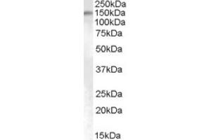 Image no. 1 for anti-SUMO1/sentrin Specific Protease 6 (SENP6) (Internal Region) antibody (ABIN375243)