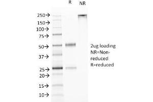 SDS-PAGE Analysis Purified TNFS15 / VEGI Monoclonal Antibody (VEGI /1283). (TNFSF15 Antikörper)