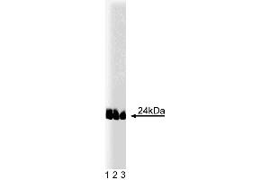 Western blot analysis of caveolin-1 (pY14) on lysates from A431 cells (Human epithelial carcinoma, ATCC CRL-1555) treated with 100 ng/mL EGF. (Caveolin Antikörper  (pTyr14))