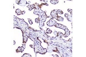 IHC analysis of AHR using anti-AHR antibody (ABIN6719265). (Aryl Hydrocarbon Receptor Antikörper)