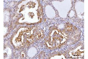 anti-Axin 2 (AXIN2) (AA 614-843) antibody