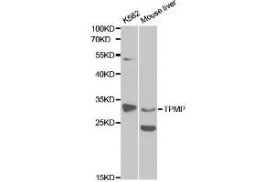 Western blot analysis of extracts of various cell lines, using TPMT antibody. (TPMT Antikörper)