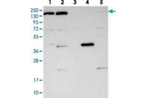 Western blot analysis of Lane 1: RT-4, Lane 2: U-251 MG, Lane 3: Human Plasma, Lane 4: Liver, Lane 5: Tonsil with POLR2B polyclonal antibody  at 1:250-1:500 dilution.