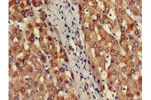 Immunohistochemistry of paraffin-embedded human liver tissue using ABIN7164093 at dilution of 1:100 (PRDM2 Antikörper  (AA 733-961))