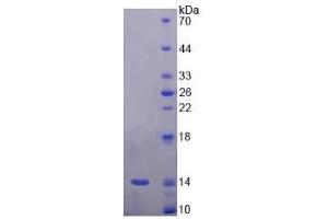 SDS-PAGE analysis of Rat Corin Protein.