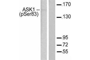 Western blot (WB) analysis of p-ASK1 antibody in paraffin-embedded human breast carcinoma tissue. (ASK1 Antikörper  (pSer966))