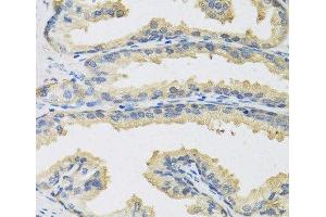 Immunohistochemistry of paraffin-embedded Human prostate using CST3 Polyclonal Antibody at dilution of 1:100 (40x lens). (CST3 Antikörper)