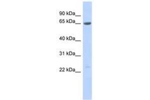 Image no. 1 for anti-Synovial Sarcoma, X Breakpoint 7 (SSX7) (AA 107-156) antibody (ABIN6743585) (SSX7 Antikörper  (AA 107-156))