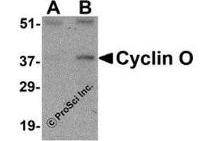 Western Blotting (WB) image for anti-Cyclin O (CCNO) (N-Term) antibody (ABIN1031340) (Cyclin O Antikörper  (N-Term))