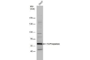 WB Image TCP1 epsilon antibody detects TCP1 protein by western blot analysis. (CCT5 Antikörper)