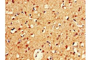 IHC image of ABIN7148735 diluted at 1:600 and staining in paraffin-embedded human brain tissue performed on a Leica BondTM system. (CELF2 Antikörper  (AA 291-381))