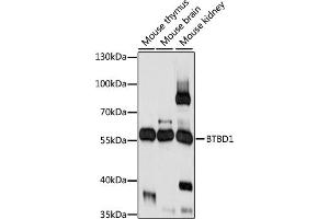 Western blot analysis of extracts of various cell lines, using BTBD1 antibody (ABIN7265952) at 1:1000 dilution.