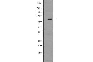 Western blot analysis of ZBTB16 expression in HL60 (Human promyelocytic leukemia cell line) Whole Cell Lysate,The lane on the left is treated with the antigen-specific peptide.
