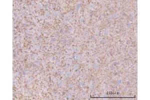 IHC analysis of PTN using anti-PTN antibody (ABIN7602164).