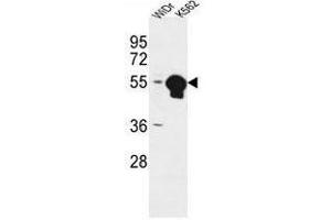 Western Blotting (WB) image for anti-ATPase, H+ Transporting, Lysosomal 56/58kDa, V1 Subunit B1 (ATP6V1B1) (AA 291-318), (Middle Region) antibody (ABIN950569)