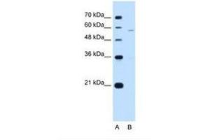 Image no. 2 for anti-Phosphatidylinositol Glycan Anchor Biosynthesis, Class V (PIGV) (AA 51-100) antibody (ABIN321251) (PIGV Antikörper  (AA 51-100))