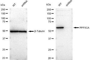 Western blotting analysis using PPP3CA antibody (ABIN7800026). (Rekombinanter PPP3CA Antikörper)