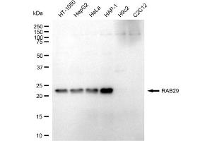 anti-RAB7, Member RAS Oncogene Family-Like 1 (RAB7L1) antibody