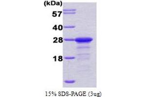 SDS-PAGE (SDS) image for Protein Phosphatase Inhibitor 1 (PPP1R1A) (AA 1-171) protein (His tag) (ABIN667056)