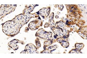 Immunohistochemistry (IHC) image for anti-Keratin 17 (KRT17) (AA 252-393) antibody (ABIN7434125)