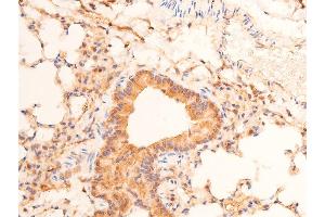 ABIN6267289 at 1/100 staining mouse lung tissue sections by IHC-P. (p53 Antikörper  (pSer15))