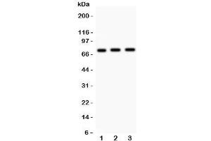 Western blot testing of Myb antibody and human samples 1:  placenta;  2: SMMC-7721;  3: HeLa lysate. (MYB Antikörper  (AA 1-201))