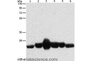 Western blot analysis of Human fetal muscle and fetal lung tissue, Human leiomyosarcoma tissue, mouse lung and heart tissue,  NIH/3T3 cell, using CAV1 Polyclonal Antibody at dilution of 1:550 (Caveolin-1 Antikörper)