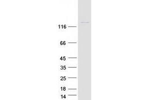 Western Blotting (WB) image for Pleckstrin and Sec7 Domain Containing 3 (PSD3) (Transcript Variant 1) protein (Myc-DYKDDDDK Tag) (ABIN2729871)