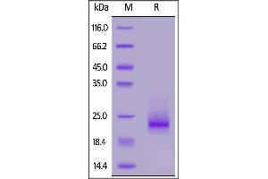 SDS-PAGE (SDS) image for Frizzled Family Receptor 10 (FZD10) (AA 21-161) protein (His tag) (ABIN7013531)