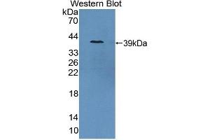 Detection of Recombinant GCPII, Porcine using Polyclonal Antibody to Prostate-specific Membrane Antigen (PMSA) (PSMA Antikörper  (AA 275-588))