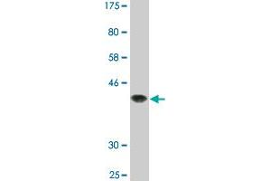 Western Blot detection against Immunogen (37. (STAT6 Antikörper  (AA 694-801))