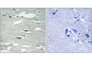 Immunohistochemistry analysis of paraffin-embedded human brain, using ILK (Phospho-Ser246) Antibody. (ILK Antikörper  (pSer246))