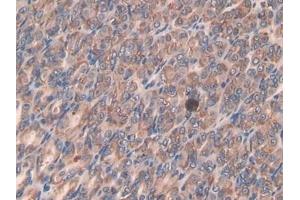 Immunohistochemistry (IHC) image for anti-Secretory Leukocyte Peptidase Inhibitor (SLPI) (AA 20-131) antibody (ABIN7433429)