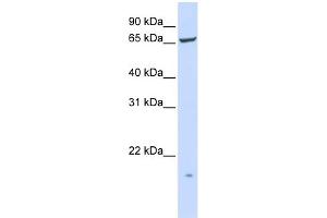 WB Suggested Anti-PIGT Antibody Titration:  0. (PIGT Antikörper  (N-Term))