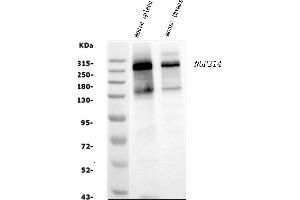 Western blot analysis of NUP214 using anti-NUP214 antibody (ABIN7601473). (NUP214 Antikörper  (AA 36-374))