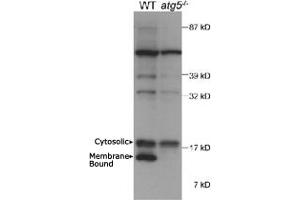 Western blot analysis of autophagic MAP1LC3A in mouse ES cell lysate using MAP1LC3A polyclonal antibody . (MAP1LC3A Antikörper  (AA 50-150))