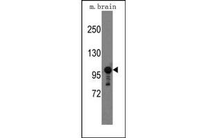 Image no. 1 for anti-Sema Domain, Seven thrombospondin Repeats (Type 1 and Type 1-Like), Transmembrane Domain (TM) and Short Cytoplasmic Domain, (Semaphorin) 5A (SEMA5A) (C-Term) antibody (ABIN357842)