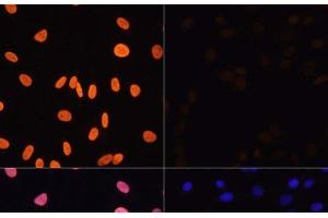 Immunofluorescence analysis of NIH/3T3 cells using Acetyl-Histone H3-K4 Polyclonal Antibody at dilution of 1:100. (Histone 3 Antikörper  (acLys4))