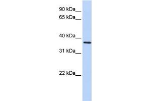 WB Suggested Anti-FBXO8 Antibody Titration: 0. (FBXO8 Antikörper  (Middle Region))