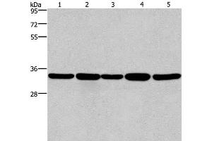 Western Blot analysis of LoVo and A549 cell, Human hepatocellular carcinoma tissue, Jurkat and Hela cell using E2F6 Polyclonal Antibody at dilution of 1:650 (E2F6 Antikörper)