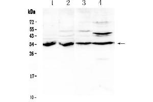 Western blot analysis of BRMS1 using anti- BRMS1 antibody . (BRMS1 Antikörper  (AA 52-244))