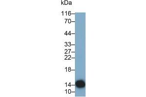 Detection of CST4 in Human Saliva using Monoclonal Antibody to Cystatin 4 (CST4) (CST4 Antikörper  (AA 21-141))