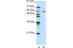 Western Blotting (WB) image for anti-Zinc Finger Protein 382 (ZNF382) antibody (ABIN2461958) (ZNF382 Antikörper)