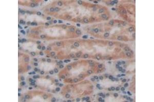 IHC-P analysis of kidney tissue, with DAB staining. (FNTA Antikörper  (AA 51-366))