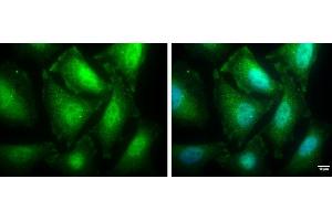Immunofluorescence (IF) image for anti-Protein Phosphatase 1, Catalytic Subunit, beta Isoform (PPP1CB) (Center) antibody (ABIN2856078)