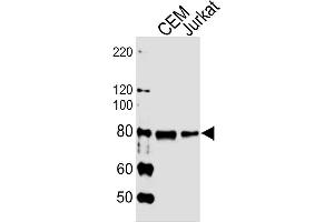 Lane 1: CEM cell lysates, Lane 2: Jurkat cell lysates probed with MYB (1279CT309. (MYB Antikörper)