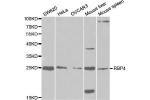 Western blot analysis of extracts of various cell lines, using RBP4 antibody (ABIN5970777) at 1/1000 dilution. (RBP4 Antikörper)